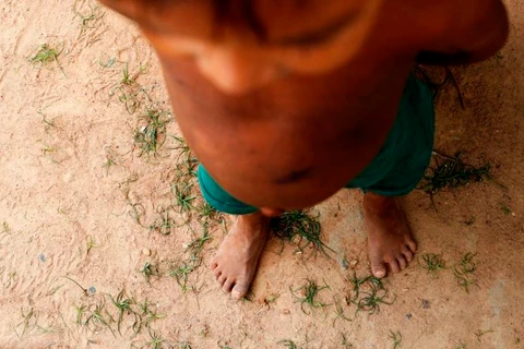 Mais uma criança yanomami morre em Roraima por desnutrição grave e desidratação