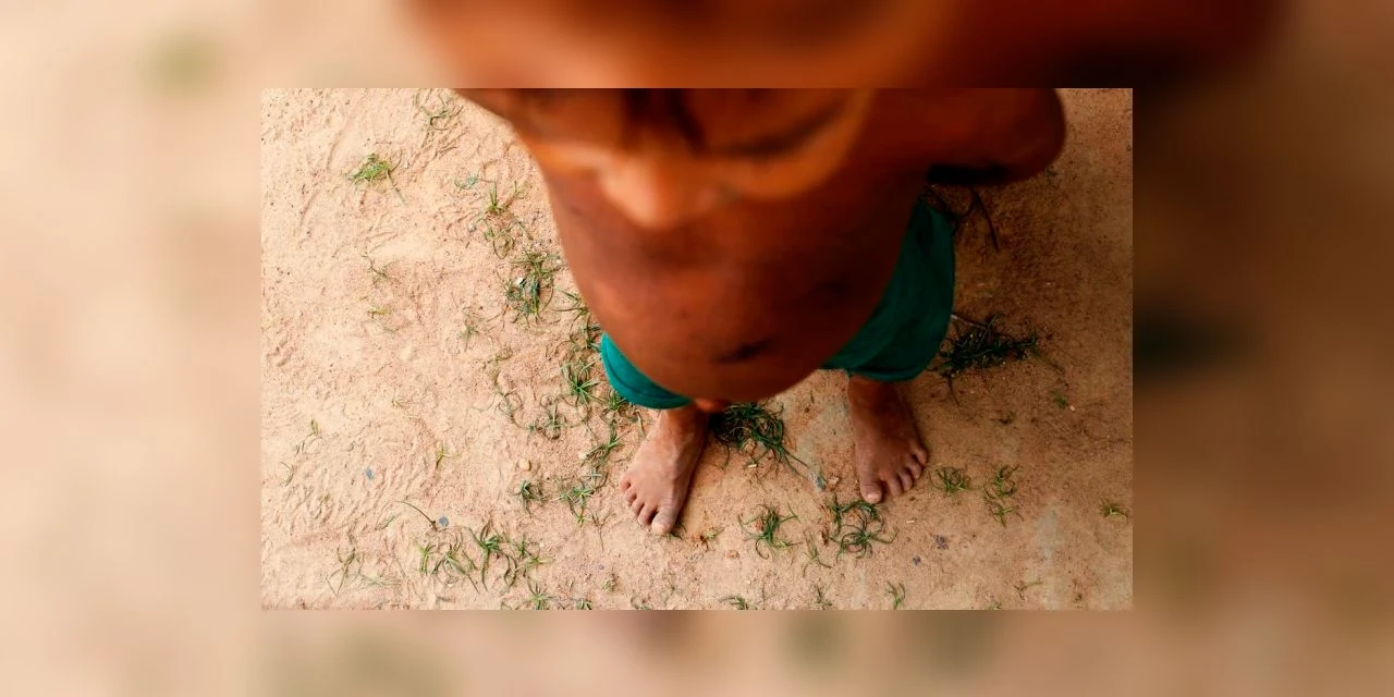 Mais uma criança yanomami morre em Roraima por desnutrição grave e desidratação