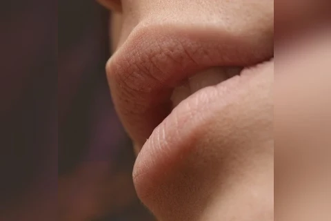 O que é a doença do beijo e como se proteger no carnaval