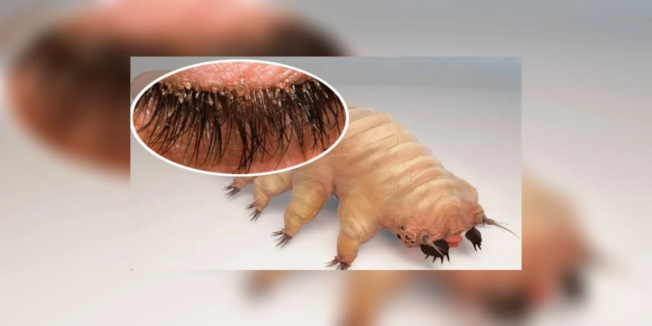 Você sabia que existe um bichinho minúsculo que faz sexo em nosso rosto?