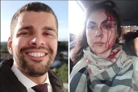 Procurador que espancou a chefe durante o trabalho é absolvido por conta de esquizofrenia paranoide; diz justiça