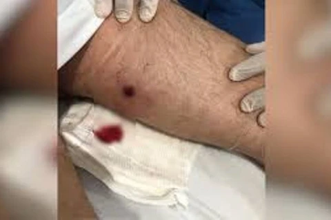 Homem reage a assalto e é baleado ao sair de casa para comprar bebidas, em PG