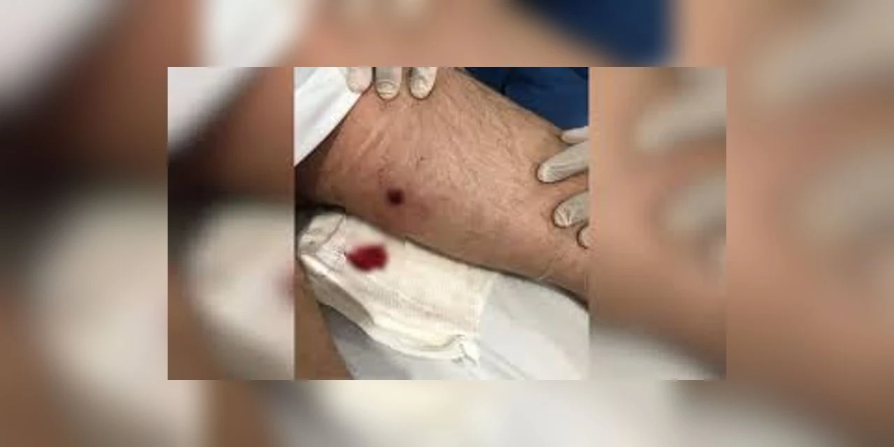 Homem reage a assalto e é baleado ao sair de casa para comprar bebidas, em PG