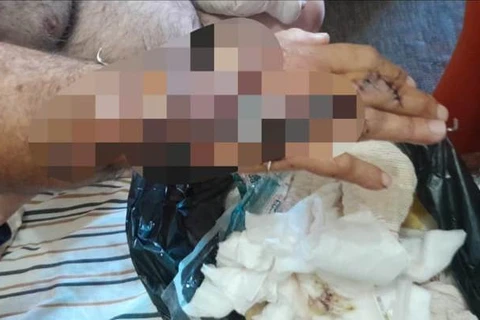 Polícia Civil prende três suspeitos de tentar assassinar caminhoneiro a golpes de facão enquanto ele dormia