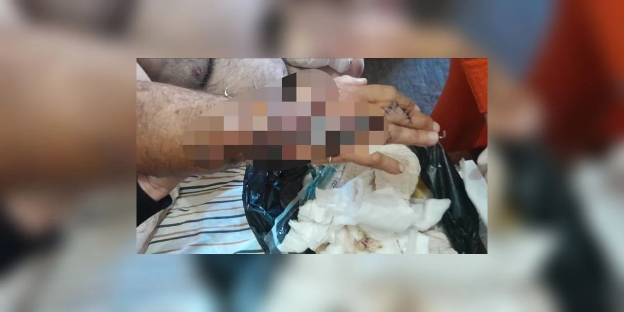 Polícia Civil prende três suspeitos de tentar assassinar caminhoneiro a golpes de facão enquanto ele dormia