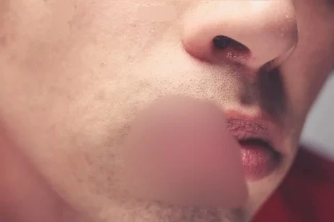 Irmão morde boca de irmão após briga familiar no interior de São Mateus do Sul