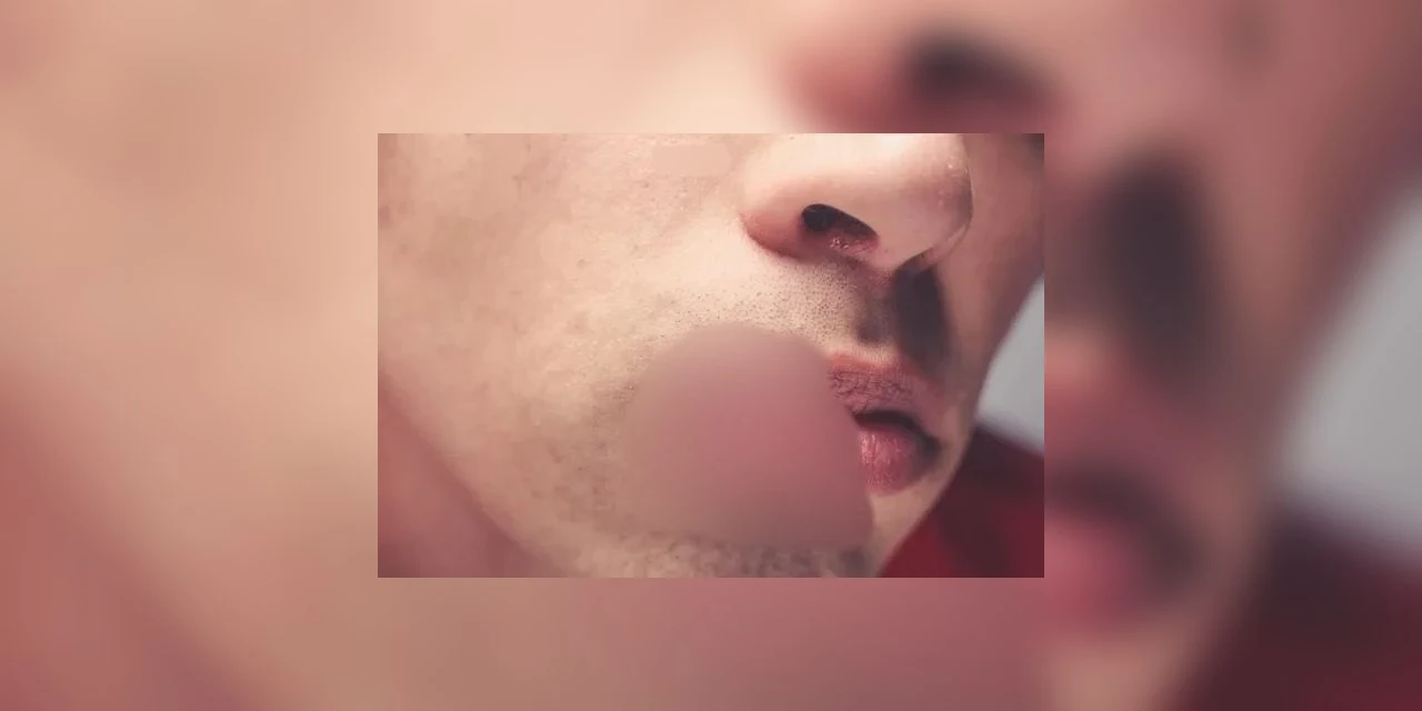 Irmão morde boca de irmão após briga familiar no interior de São Mateus do Sul