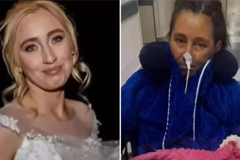 Mulher é internada para laqueadura e acorda sem perna e com transplante de coração