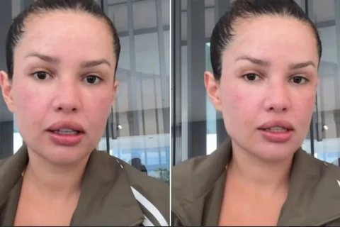 Rosto de Juliette incha após uso de 'esperma de salmão'