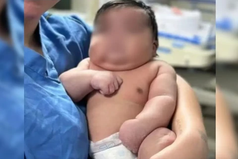 Mãe leva 50 pontos após parto normal de bebê de 6,5 quilos