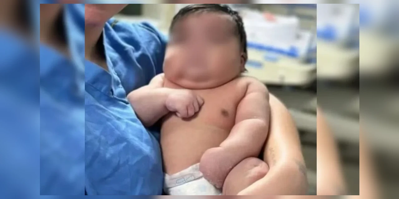 Mãe leva 50 pontos após parto normal de bebê de 6,5 quilos