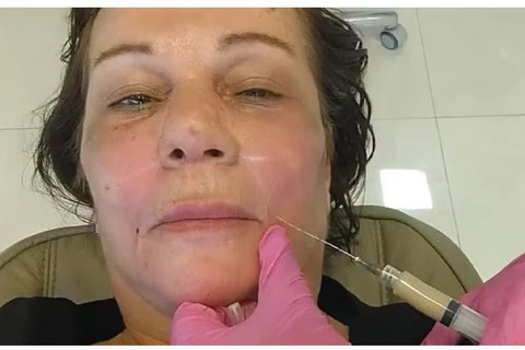 Mulher que morreu após procedimentos estéticos pagou R$ 15 mil a estudante de biomedicina investigado por exercício ilegal da medicina, no PR