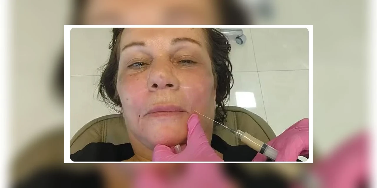 Mulher que morreu após procedimentos estéticos pagou R$ 15 mil a estudante de biomedicina investigado por exercício ilegal da medicina, no PR