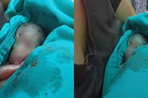 Recém-nascido dado como morto chora dentro do caixão durante sepultamento