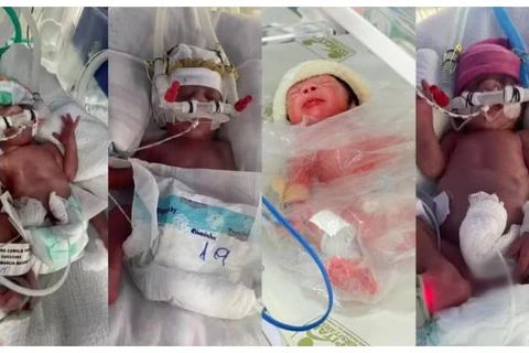 Após casal tentar ter filhos por quatro anos, quadrigêmeos nascem no Paraná