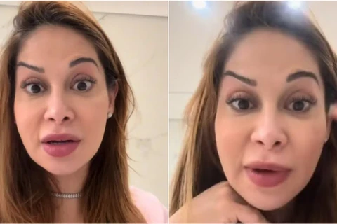 Maíra Cardi faz botox e fica torta: "Palhaçada"