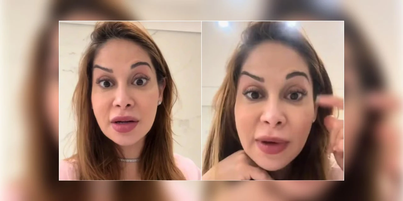 Maíra Cardi faz botox e fica torta: "Palhaçada"