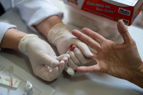 Com testagem e tratamento adequado, PG  é referência no cuidado contra o HIV/AIDS 