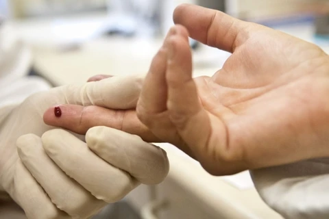 Paraná tem uma das menores taxas de mortalidade por aids no País, aponta estudo