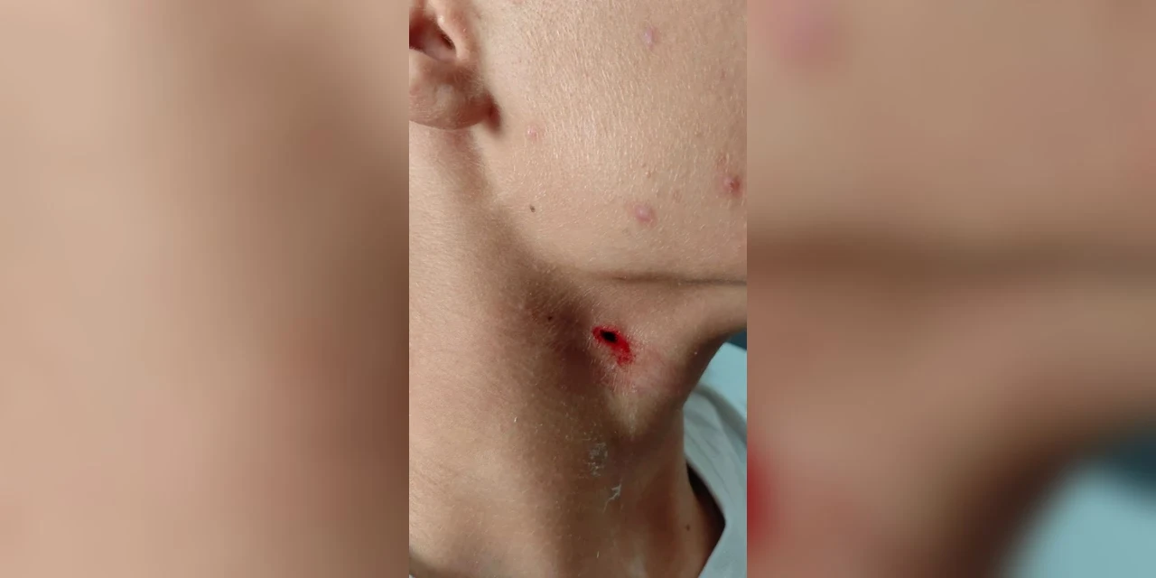 Polícia apreende adolescente por tentativa de homicídio após golpe com caneta no pescoço em escola